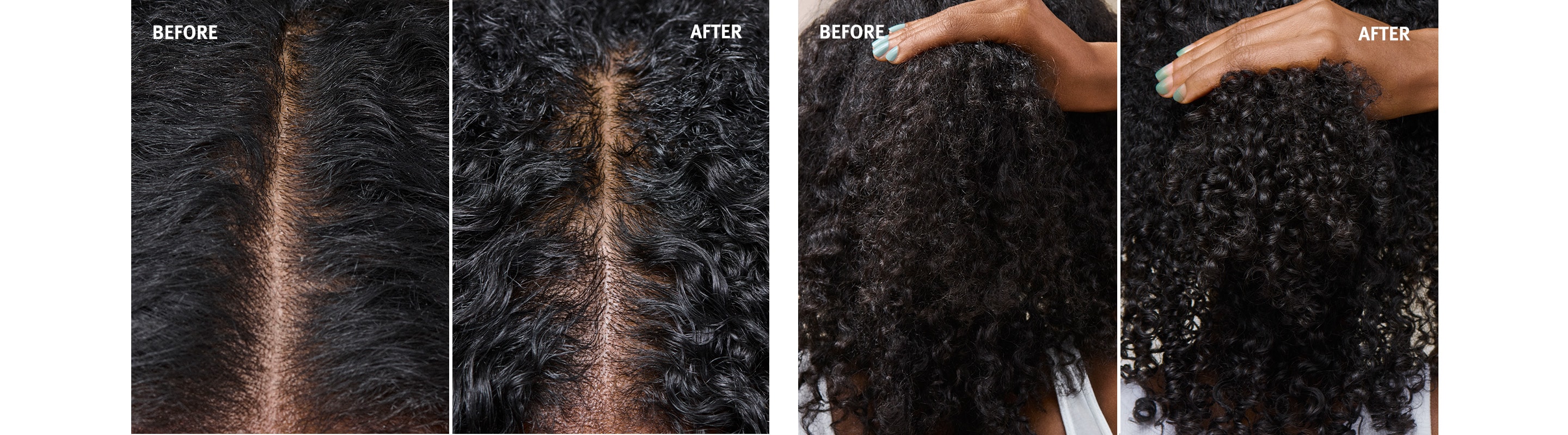 See the difference when using scalp solutions