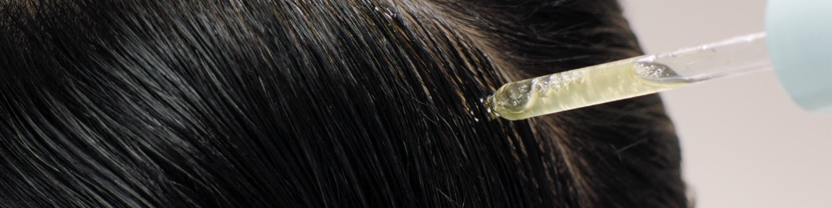 Healthy looking hair starts with a hydrated scalp.